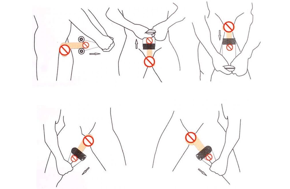 جيلقينج لتكبير القضيب